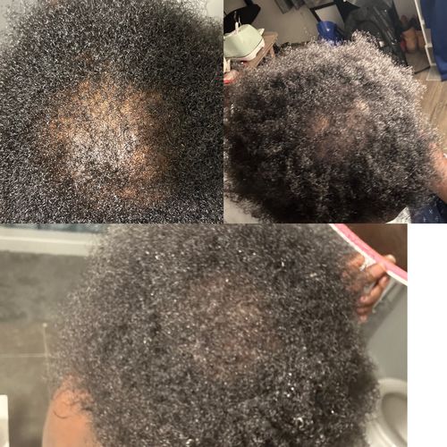 Customer photo review of Herbal Hair/Beard Growth Oil