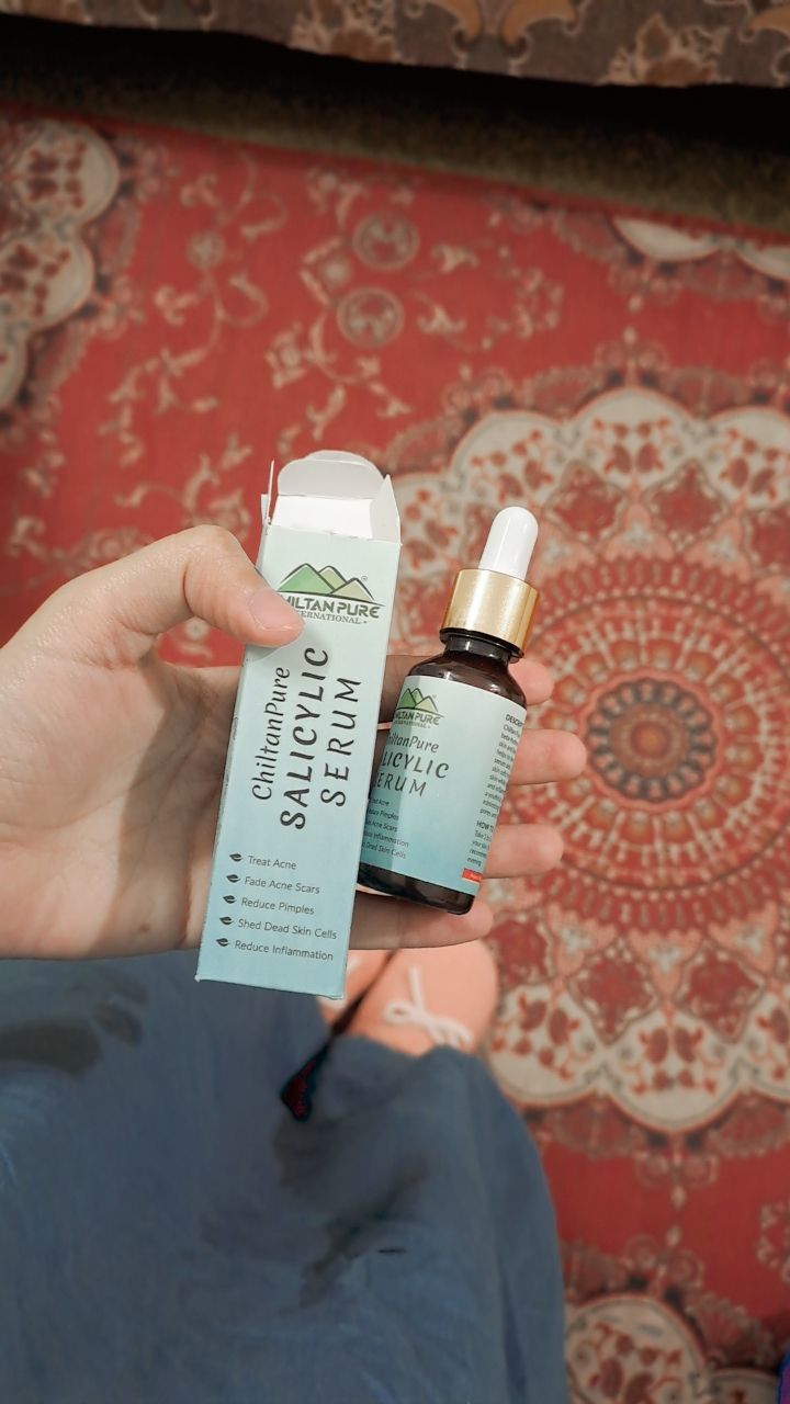 Customer photo review of Salicylic Serum - Amazing Serum for Acne Reduction