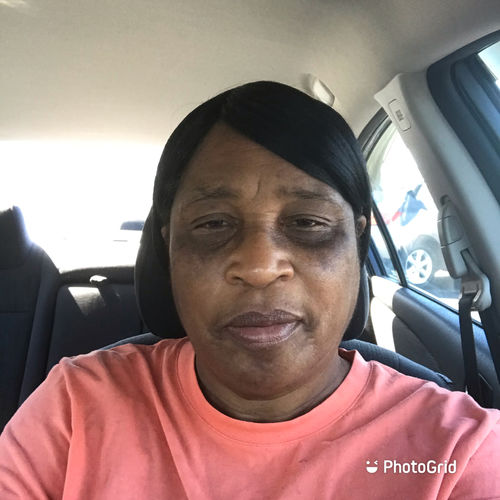 Customer photo review of Scalp Soothing Mist