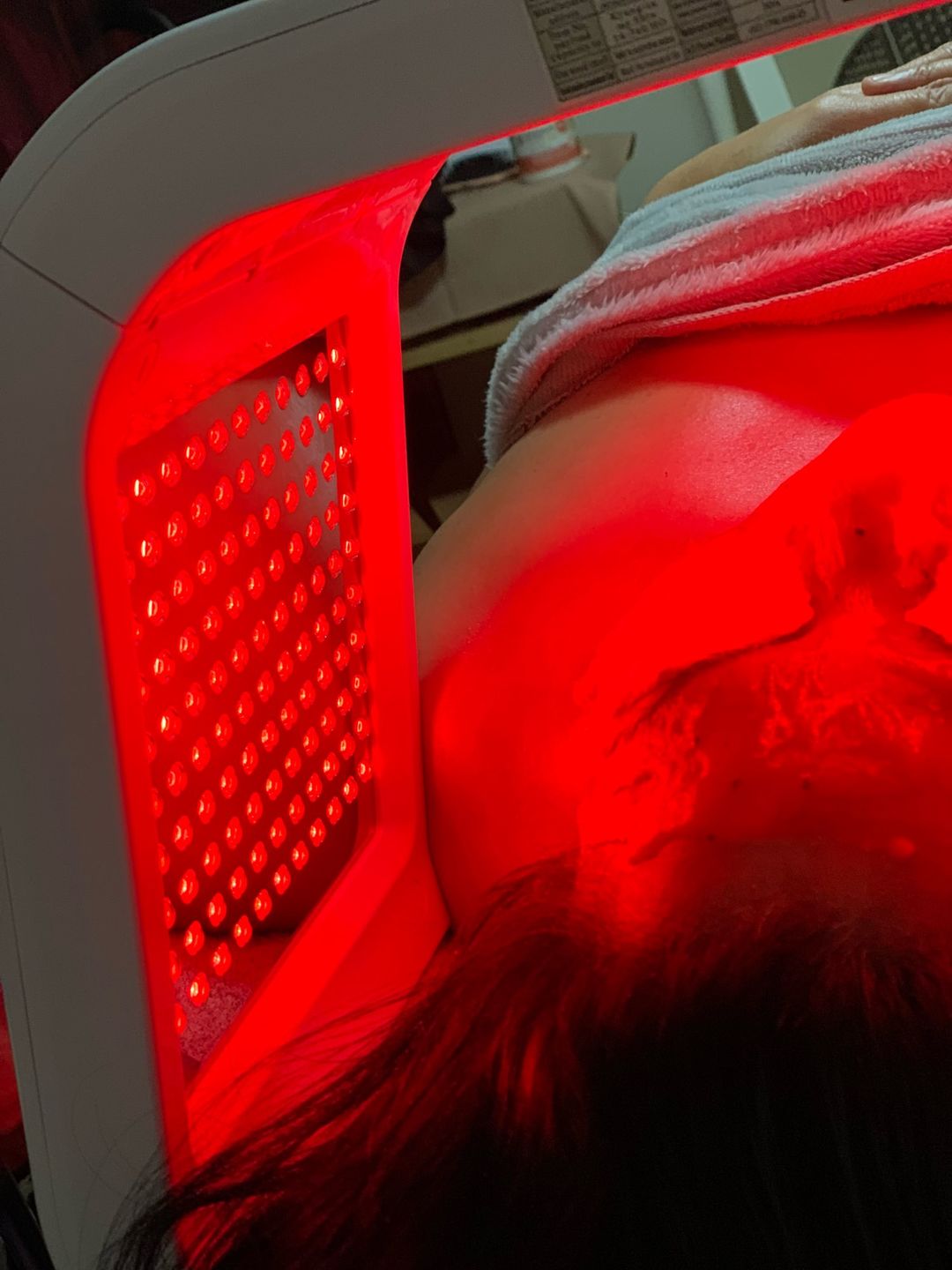Customer photo review of 4 Colors LED Light Facial Therapy Skin Care Rejuvenation
