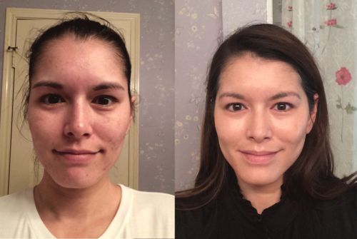 Customer photo review of HudElixir™ #1 Serum För Anti-Rynk Och Mörka Fläckar