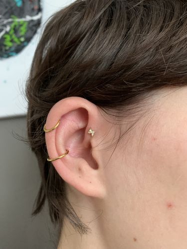 Customer photo review of Hi-Life Flash Labret Piercing