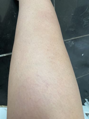 Customer photo review of Depilador Nuva Skin®