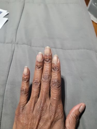 Customer photo review of Rocket Nail Fuel Duo