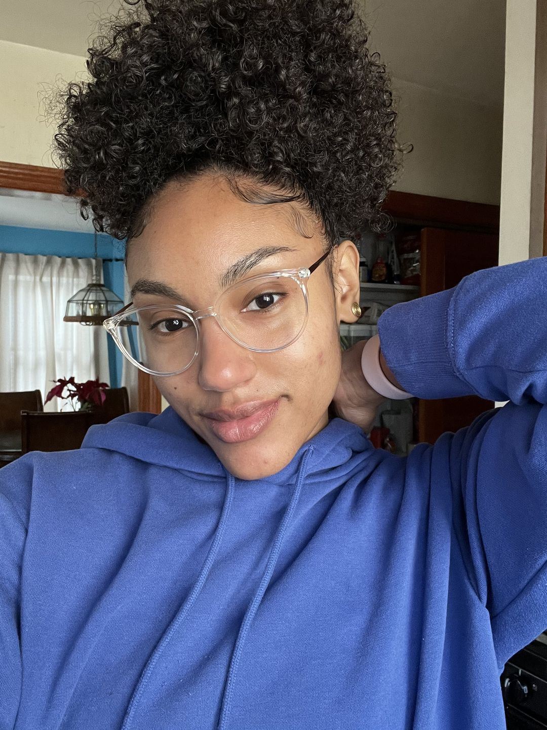 Customer photo review of Acne Prevention Kit