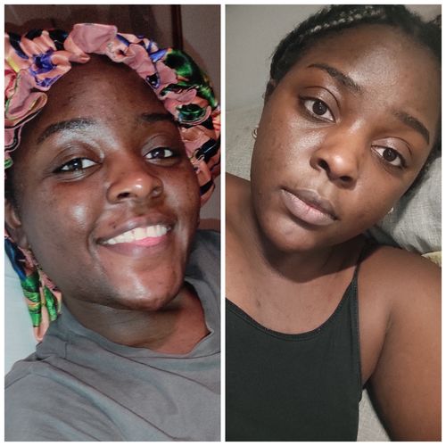 Customer photo review of HYPER G[L]O - Renewing Night Serum