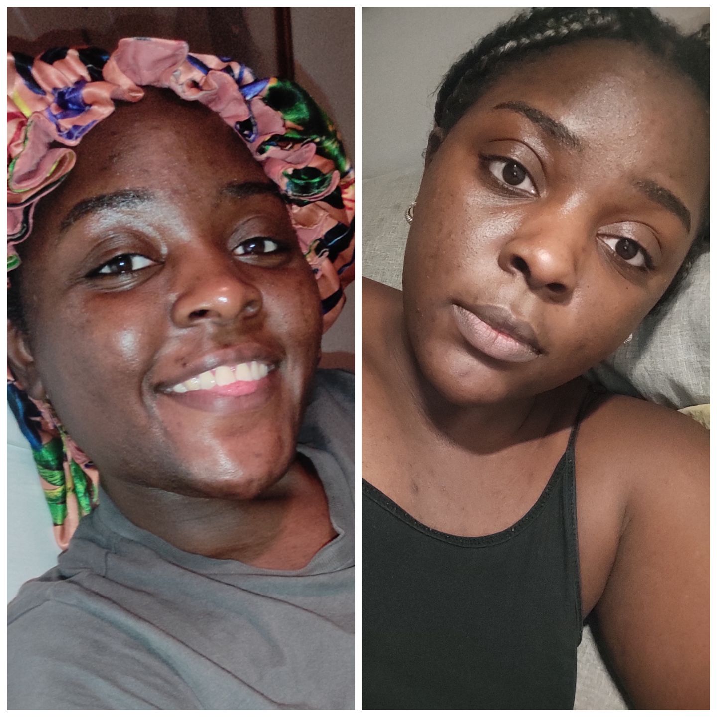 Customer photo review of HYPER G[L]O - Renewing Night Serum