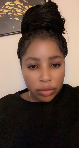 Customer photo review of Organic Exfoliating Cream with SPF (for darks spots and sunburns)
