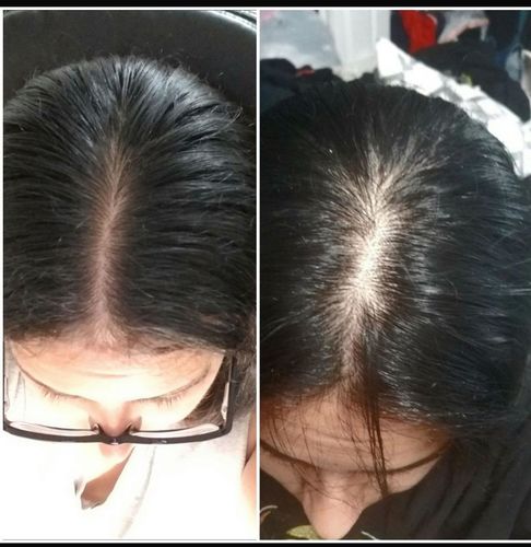 Customer photo review of HårExpert™ Naturlig Hårväxtolja