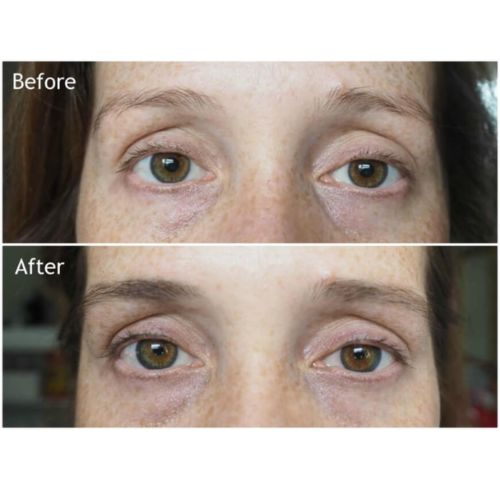 Customer photo review of SHOW BROW