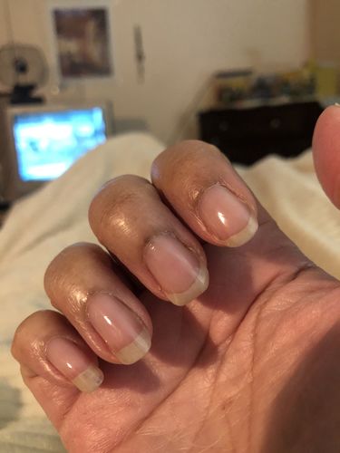 Customer photo review of Route Package Protection