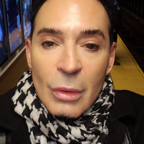 Customer photo review of WrinkleFix: Botox Membership Auto renew (Ships every 30 Days)