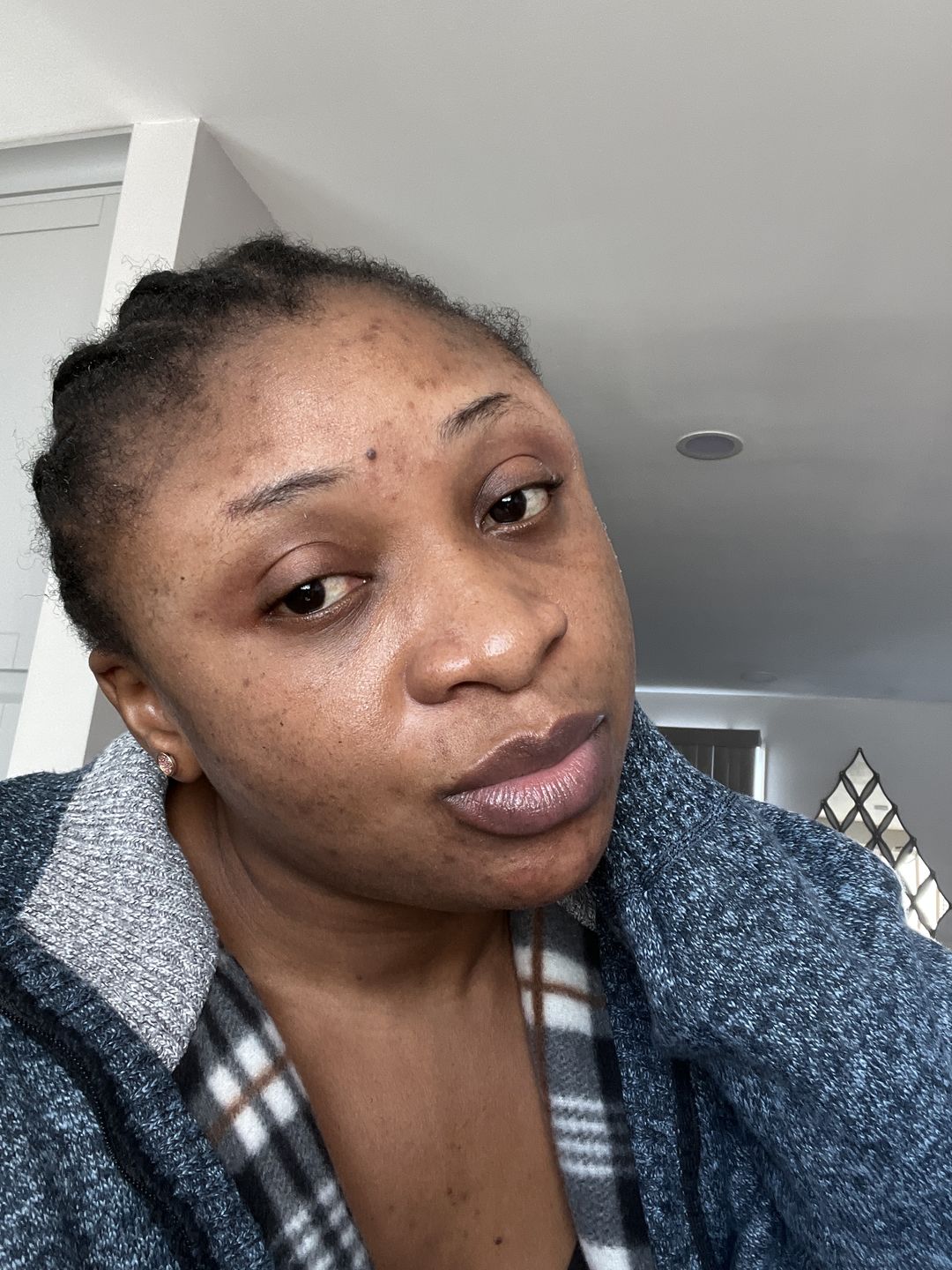 Customer photo review of Fair and White Exclusive Whitenizer Serum with Pure Vitamin "C" 30 ml / 1 fl oz