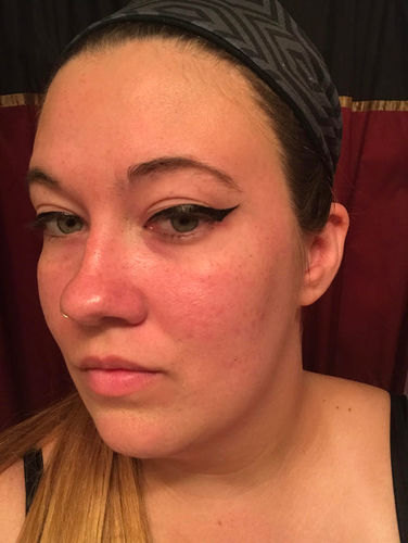 Customer photo review of DubblaEyelids™ Kompletta Ögonlocksstylingset