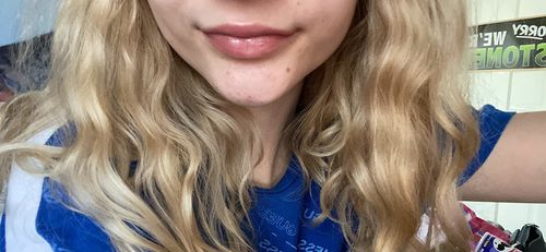 Customer photo review of LipFix™ Läppblekande Balsam