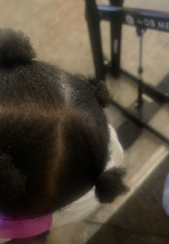 Customer photo review of Scalp Bundle