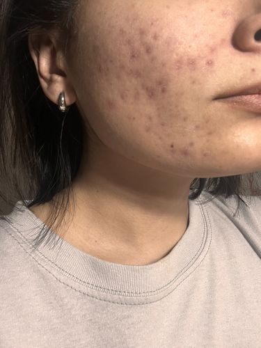 Customer photo review of Rutina Personalizada