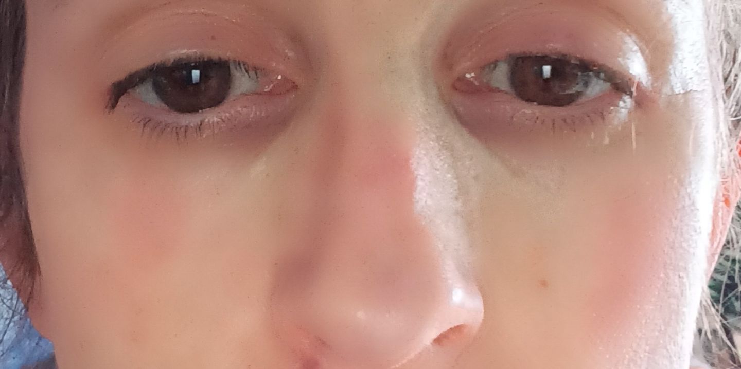 Customer photo review of Healing Miracle Cream