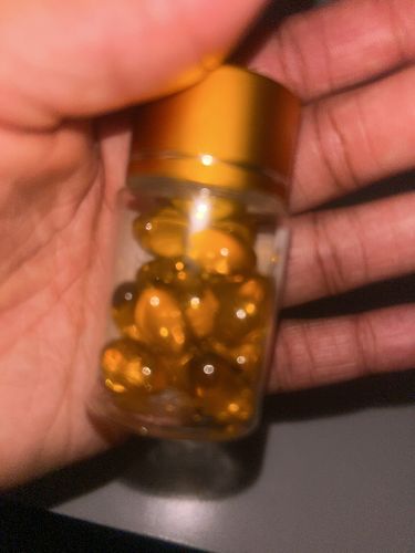 Customer photo review of The Big O Tightening Pops