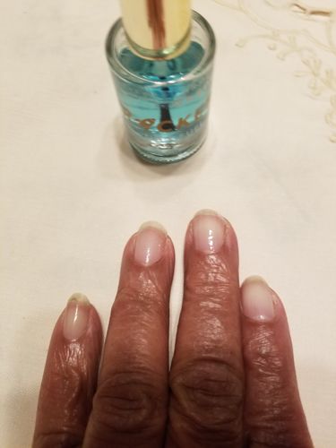 Customer photo review of Rocket Nail Fuel Starter Kit