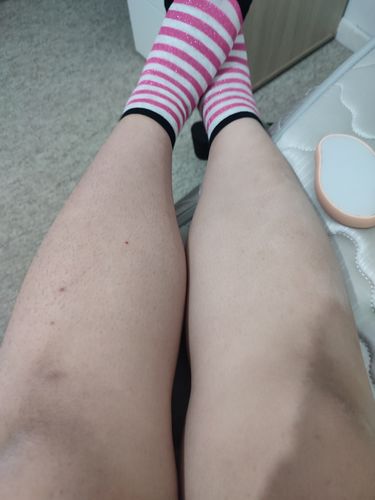 Customer photo review of Depilador Nuva Skin®