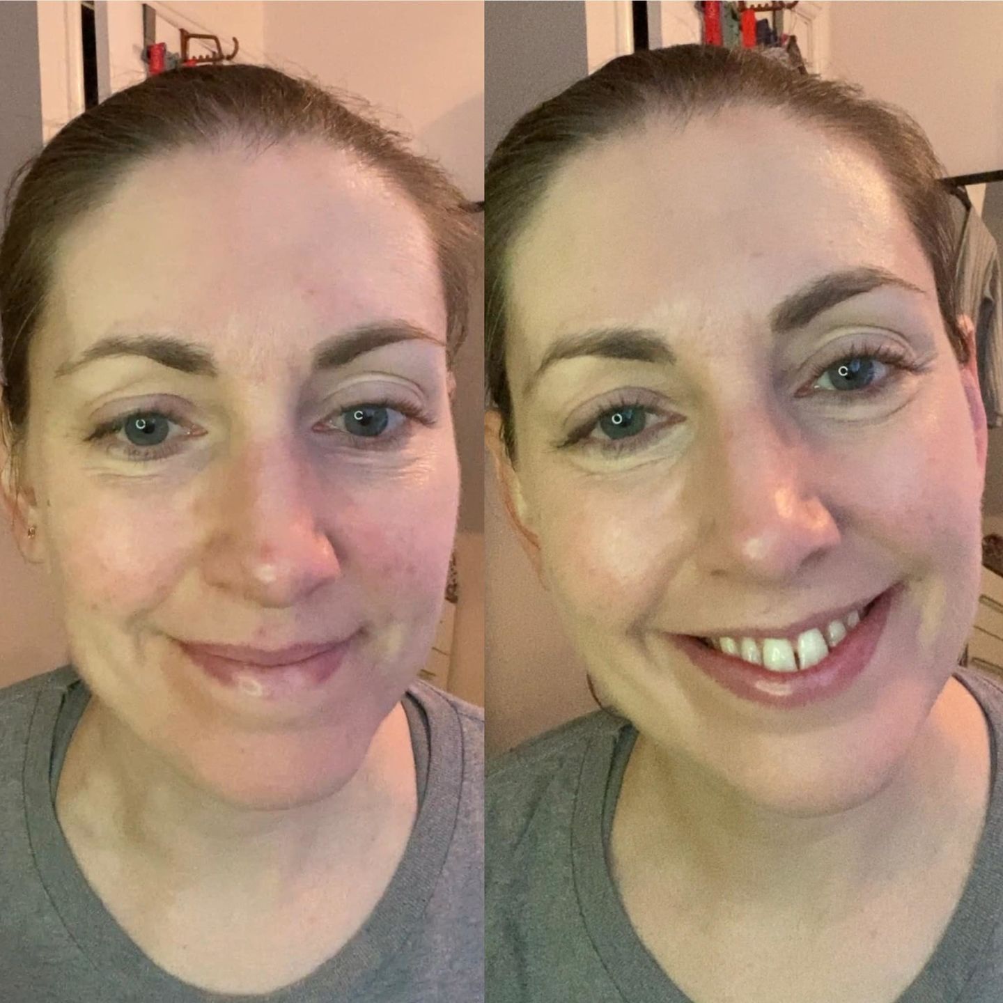 Customer photo review of Pure Pigment Foundation Drops