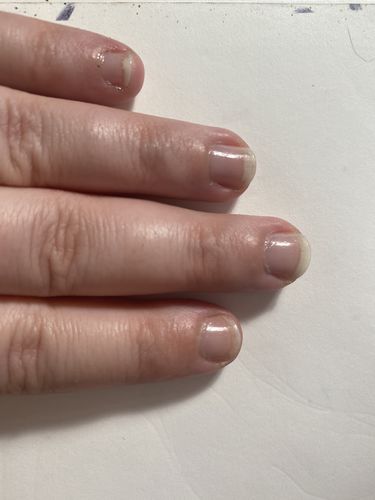 Customer photo review of Rocket Nail Fuel Repair Original Duo