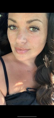 Customer photo review of Night Bond®