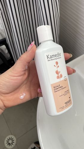 Customer photo review of שמפו טיפולי נגד קשקשים | SEBO DANDRUFF SHAMPOO