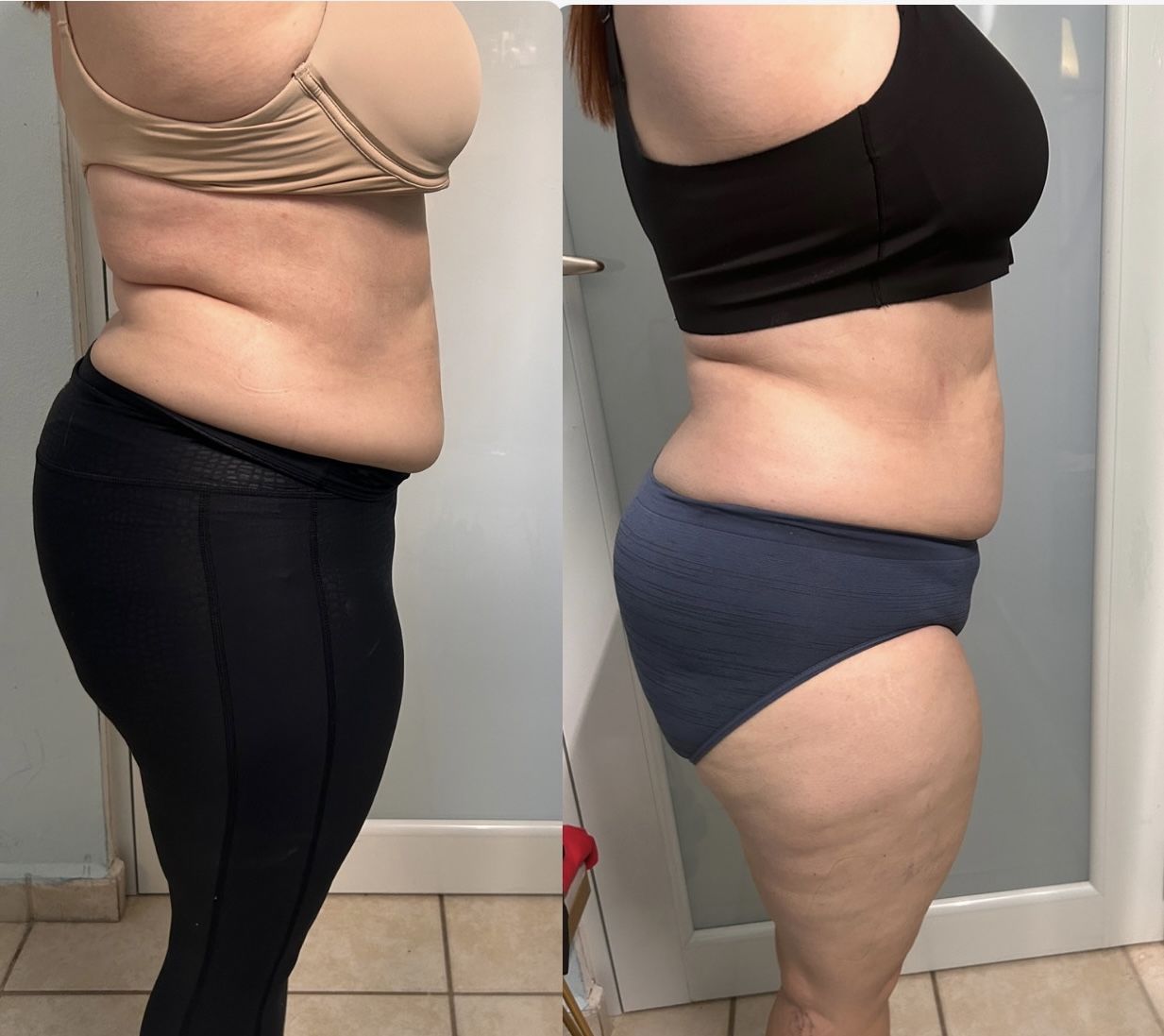 Customer photo review of Lipolimus Extracto de Alcachofa - Denova - Adelgazante y Anticelulítico