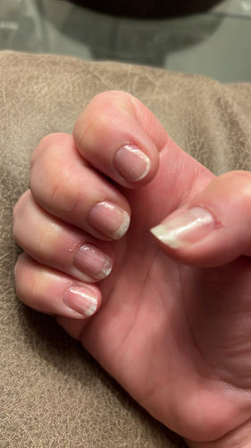 Customer photo review of The Nail System