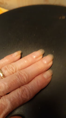 Customer photo review of Rocket Nail Fuel Duo