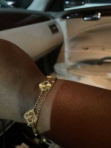 Customer photo review of Clove Bracelet