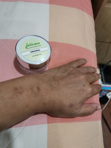 Customer photo review of Jolicare Cream