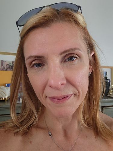 Customer photo review of EyeFix: Filler