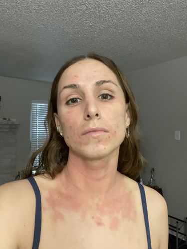 Customer photo review of Mattifying Day Serum
