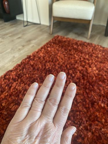 Customer photo review of Route Package Protection