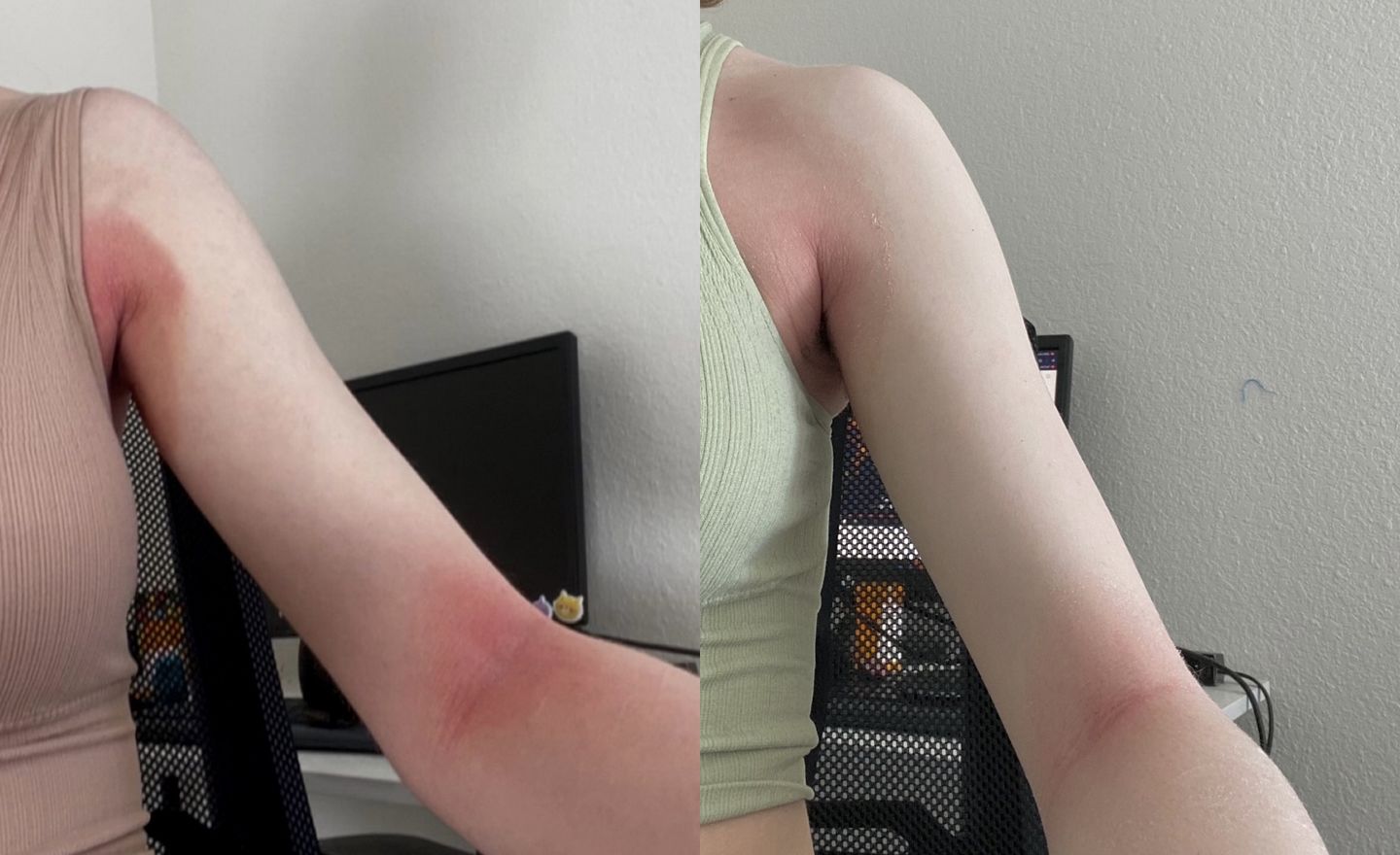 Customer photo review of TONE DOWN BODY CREAM