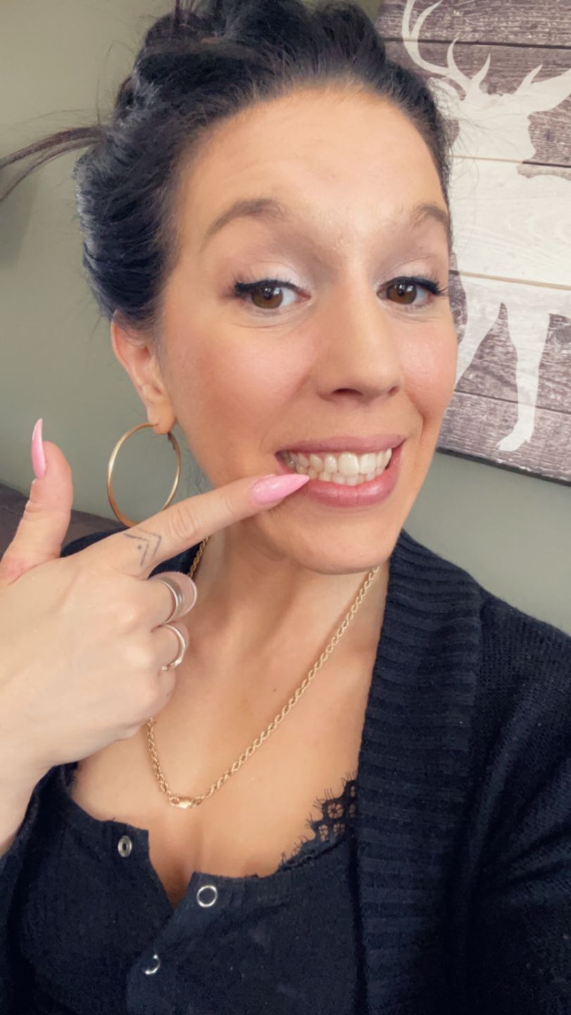 Customer photo review of Bandes Blanchissantes PAP (sans peroxyde)