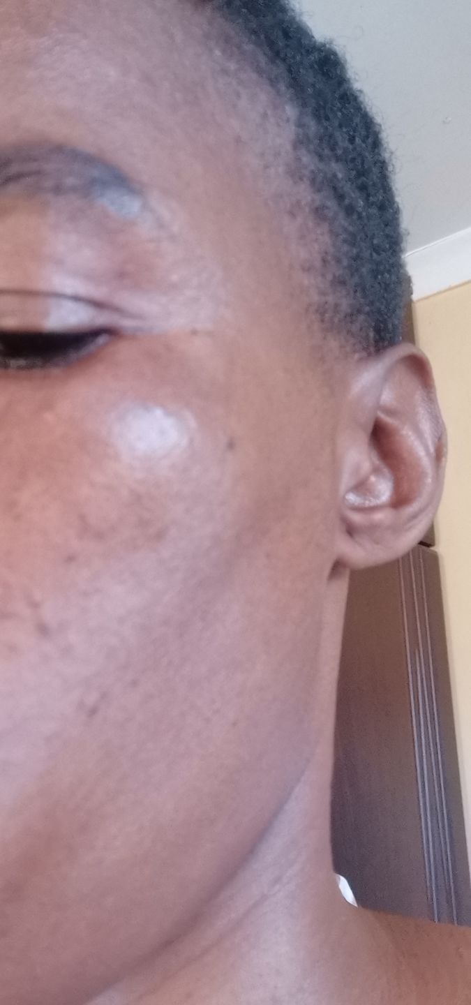 Customer photo review of Gmaeum Clear Complexion Set