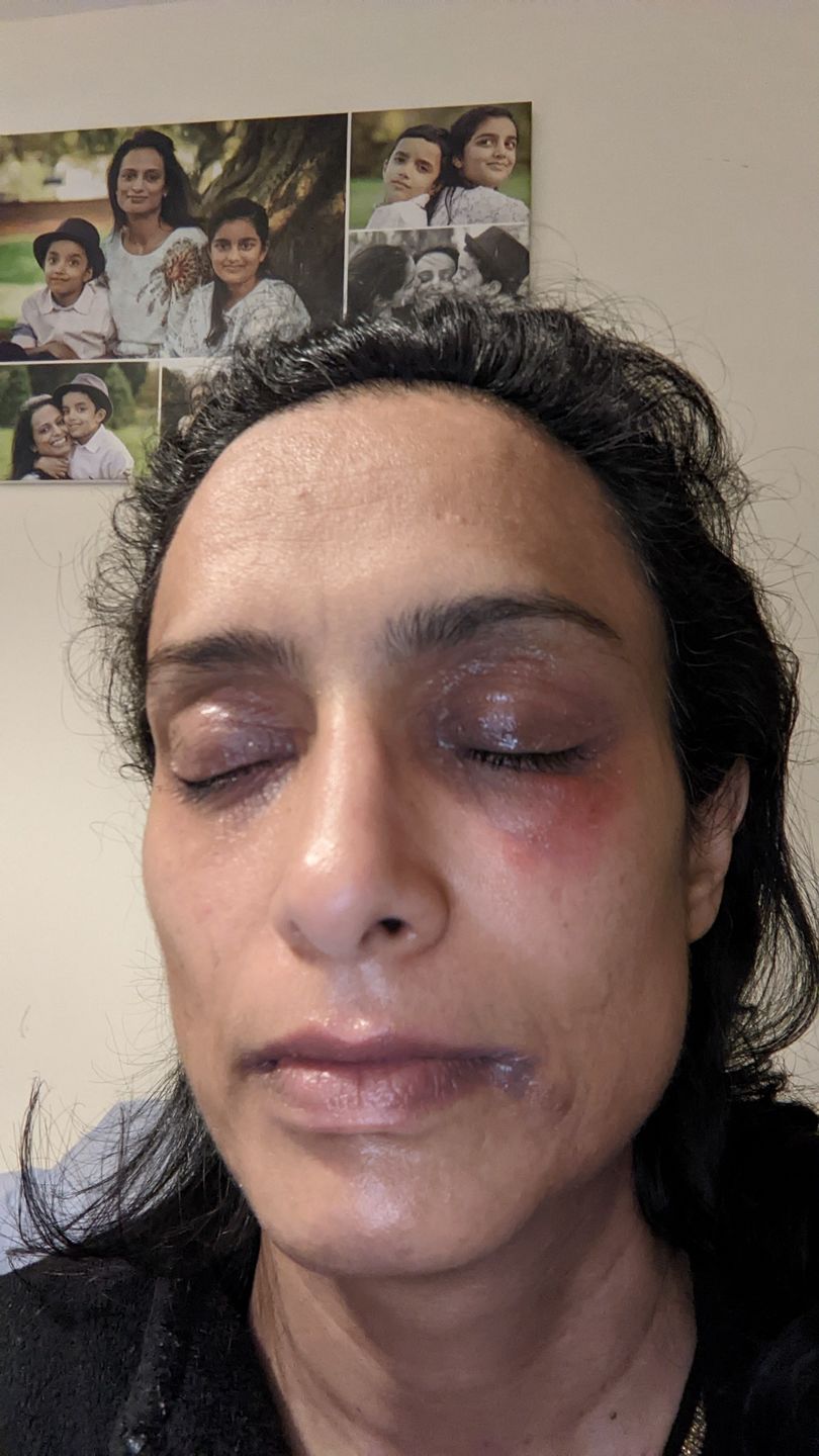 Customer photo review of Skin Saviour Balm