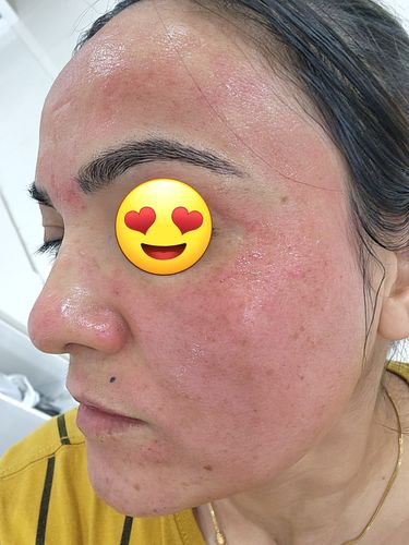 Customer photo review of Femvy LED Light Therapy Pod