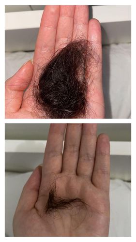 Customer photo review of Growth & Shine Hair Oil