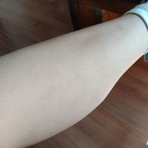 Customer photo review of Depilador Nuva Skin®