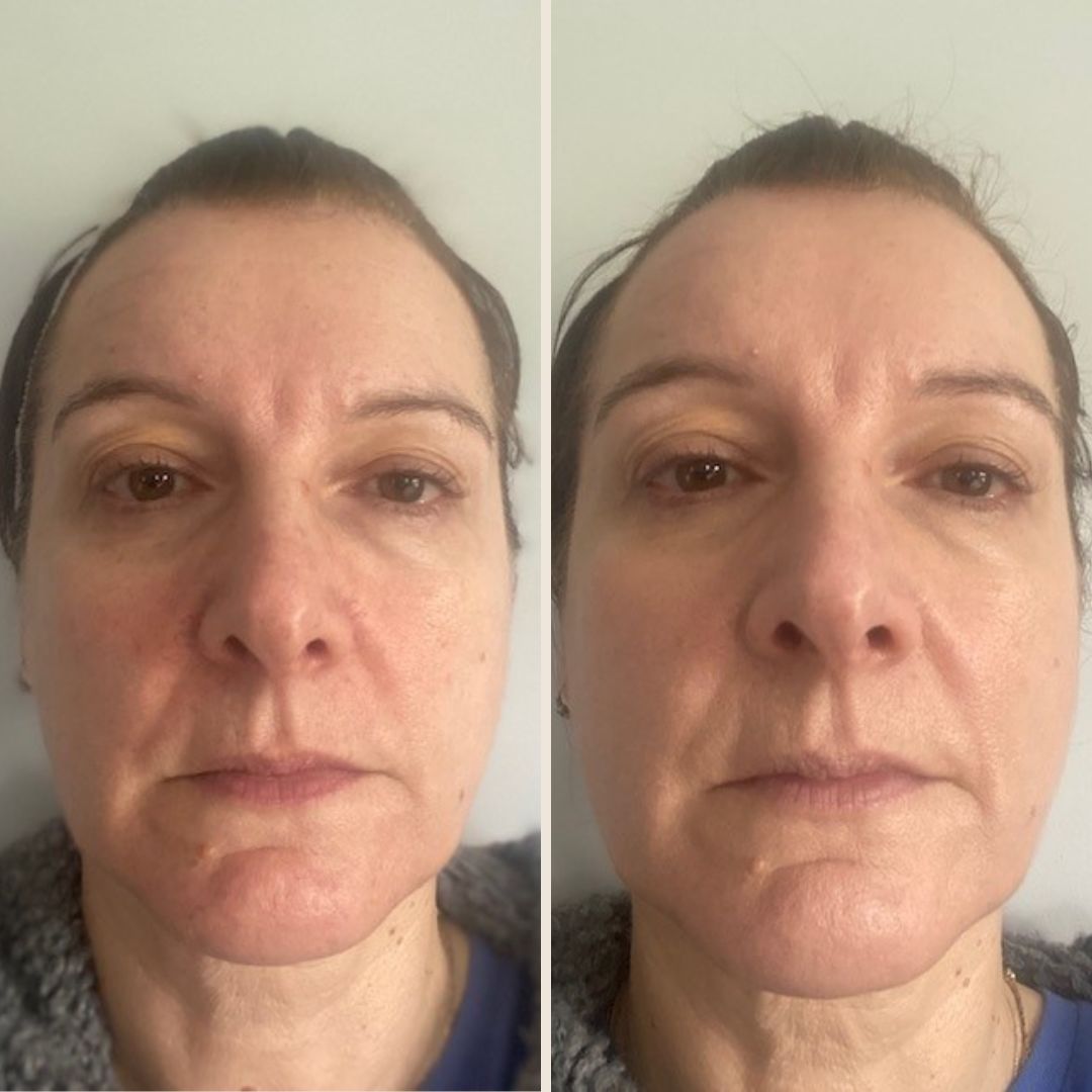 Customer photo review of Pure Pigment Foundation Drops