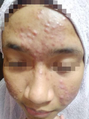 Customer photo review of Brightening Face Creme