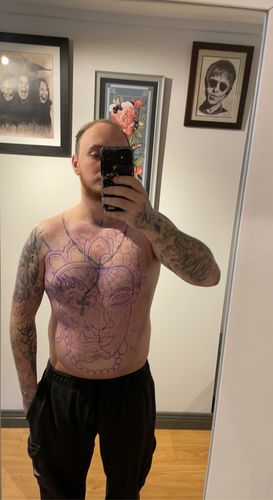 Customer photo review of TattooNumbx Numbing Cream