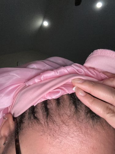 Customer photo review of Intensive Scalp Oil