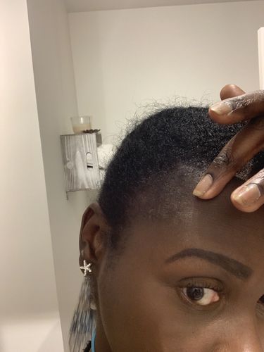 Customer photo review of Hair Recovery Bundle