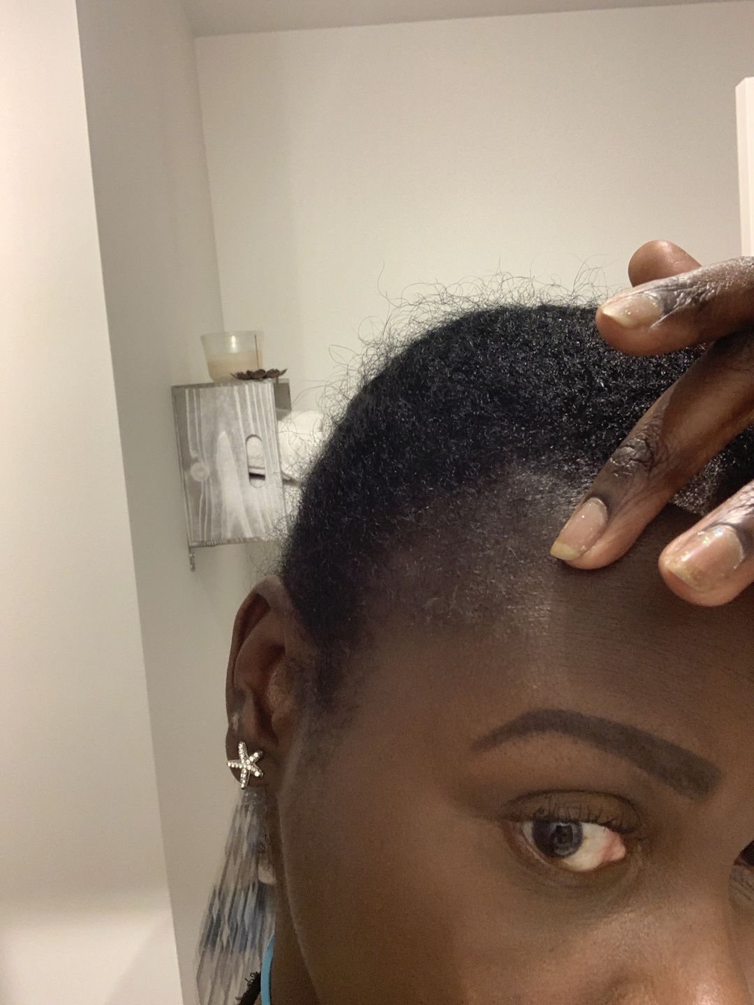 Customer photo review of Hair Recovery Bundle